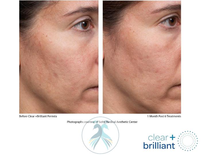 Before & After Clear + Brilliant® Case 10 View 1 View in The Woodlands, TX