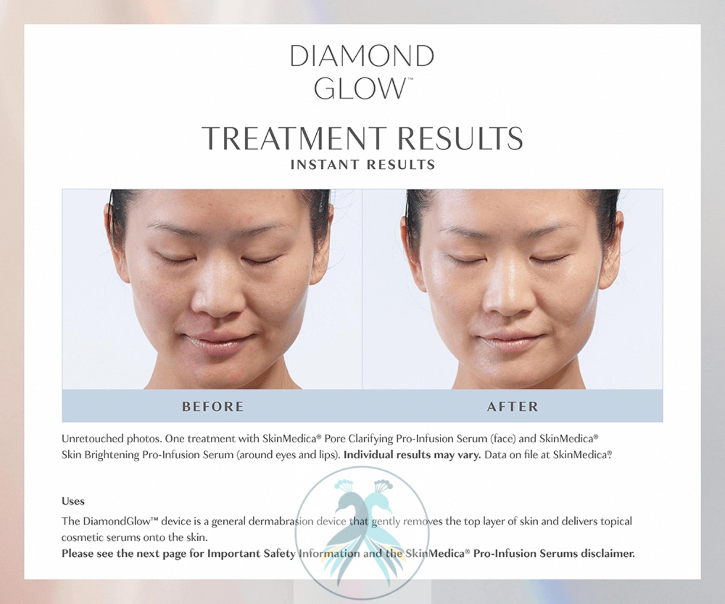 Before & After DiamondGlow® Case 16 View 1 View in The Woodlands, TX