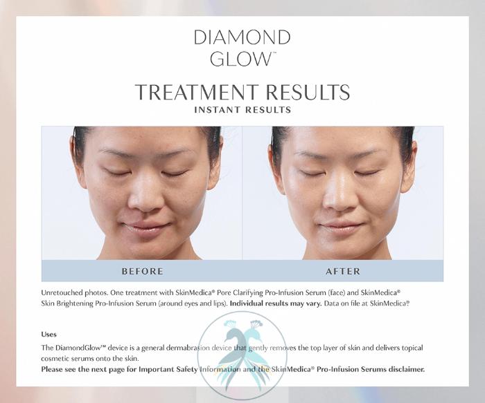 Before & After DiamondGlow® Case 16 View 1 View in The Woodlands, TX