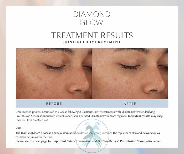Before & After DiamondGlow® Case 17 View 1 View in The Woodlands, TX